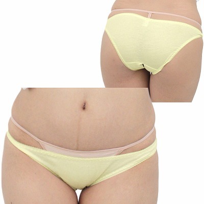 �L�k�����Q�R�b�g���ҊJ���t���o�b�N�@�C�G���[